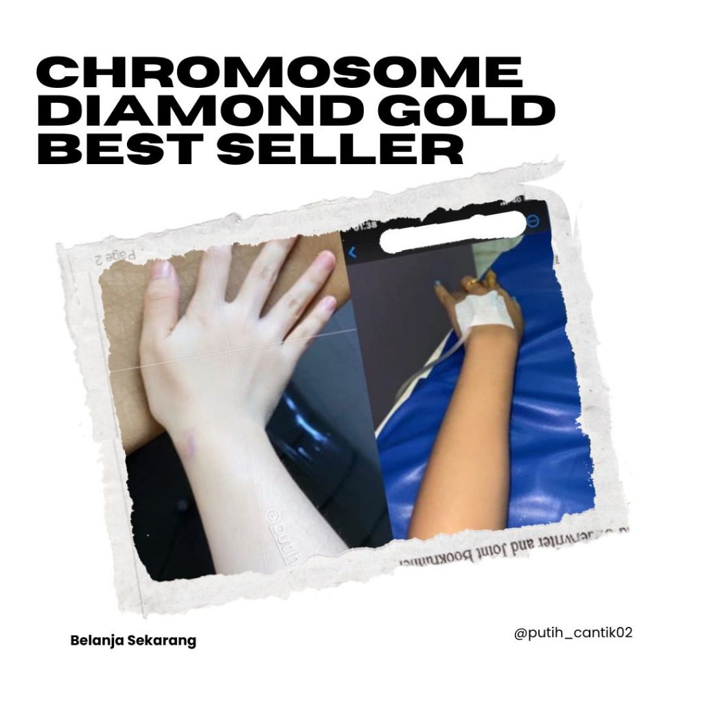 Chromosome Diamond Gold Pack