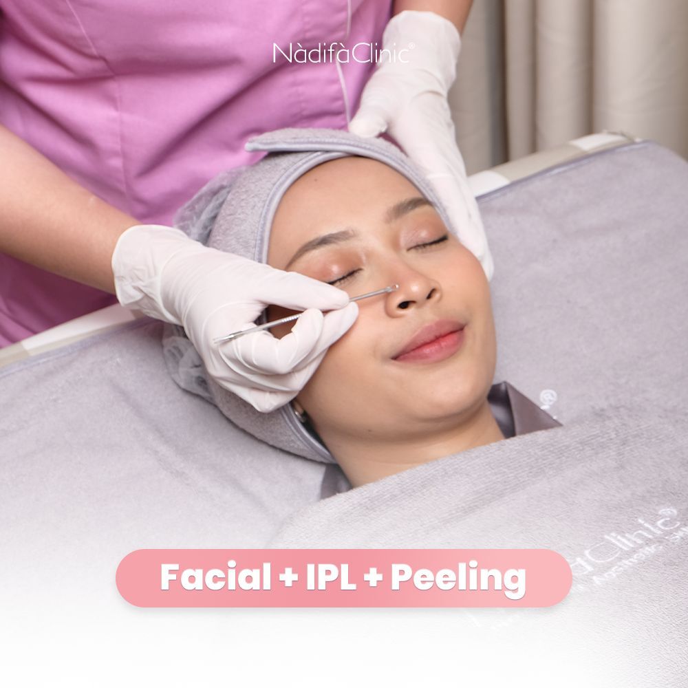 TREATMENT FACIAL + IPL + PEELING