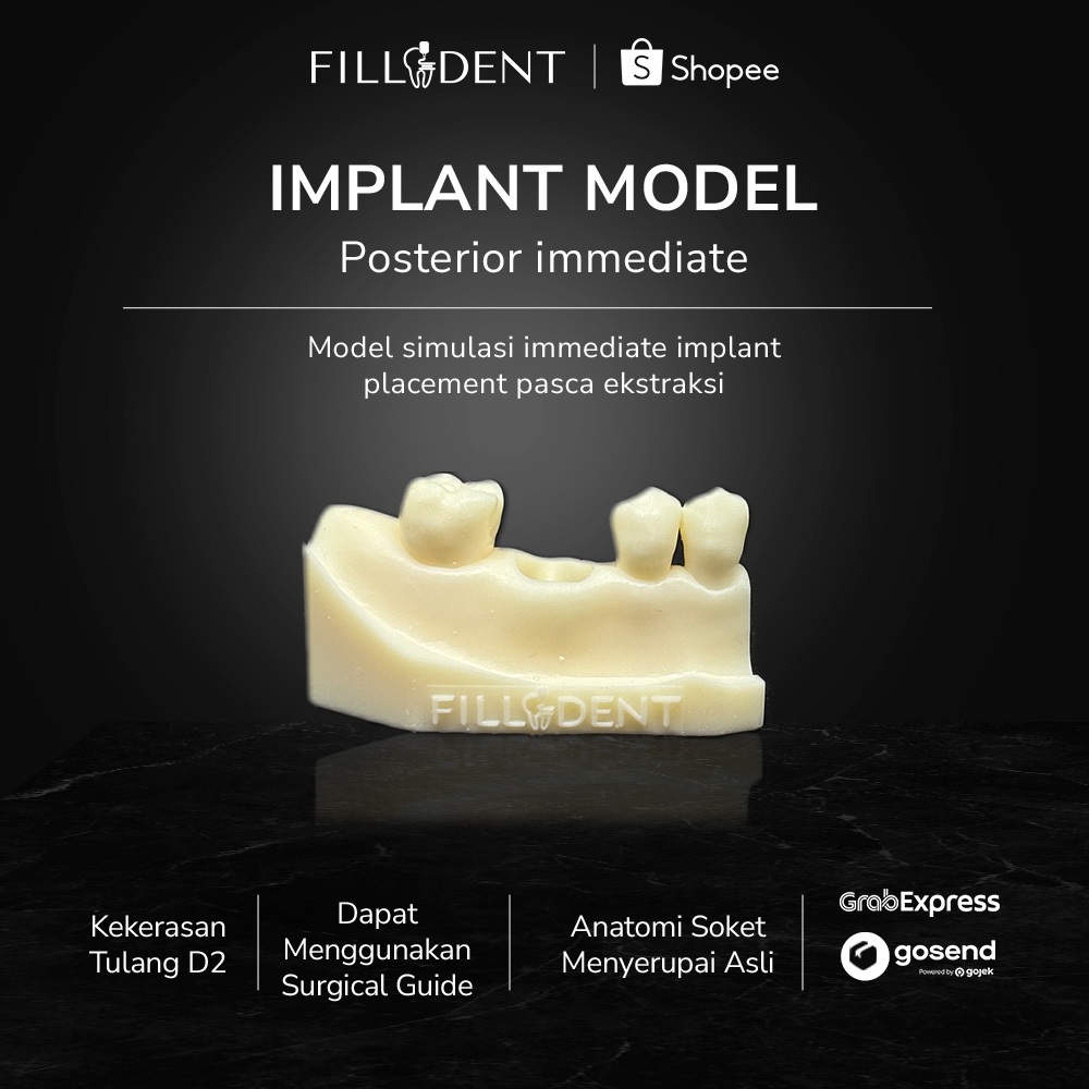 Filladent Implant Model – Dental Implant Training Model | Bone D2 | Single Implant, Immediate Implan