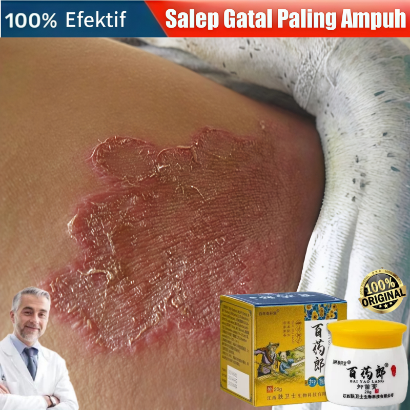 Salap gatal kulit yang ampuh Salep eksim Saleb gatal paling ampuh Salep gatal selangkangan Salep Kur