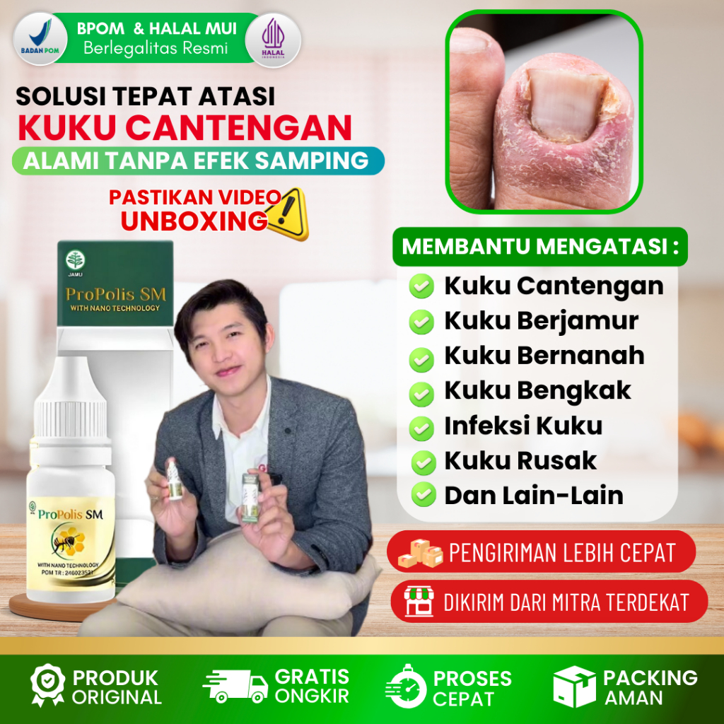 Obat Tetes Oles Kuku Jempol Kaki Cantengan - Obat Kuku Rusak - Busuk - Bernanah - Bengkak (BPOM RI)