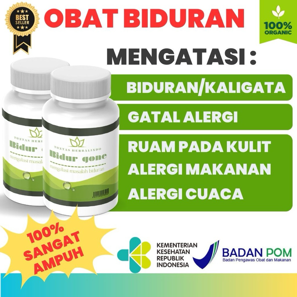 OBAT BIDURAN KALIGATA ALERGI