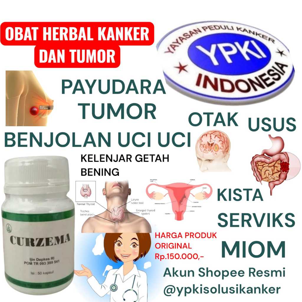 CURZEMA OBAT KANKER PARU PARU STADIUM 1 ll OBAT KANKER OTAK  ll OBAT KANKER KULIT GATAL ll OBAT KANK