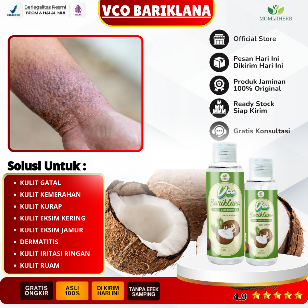 Vco Bariklana Minyak Kelapa Membantu Mengobati Dermatitis, Obat Gatal Paling Ampuh, Obat Gatal Selan