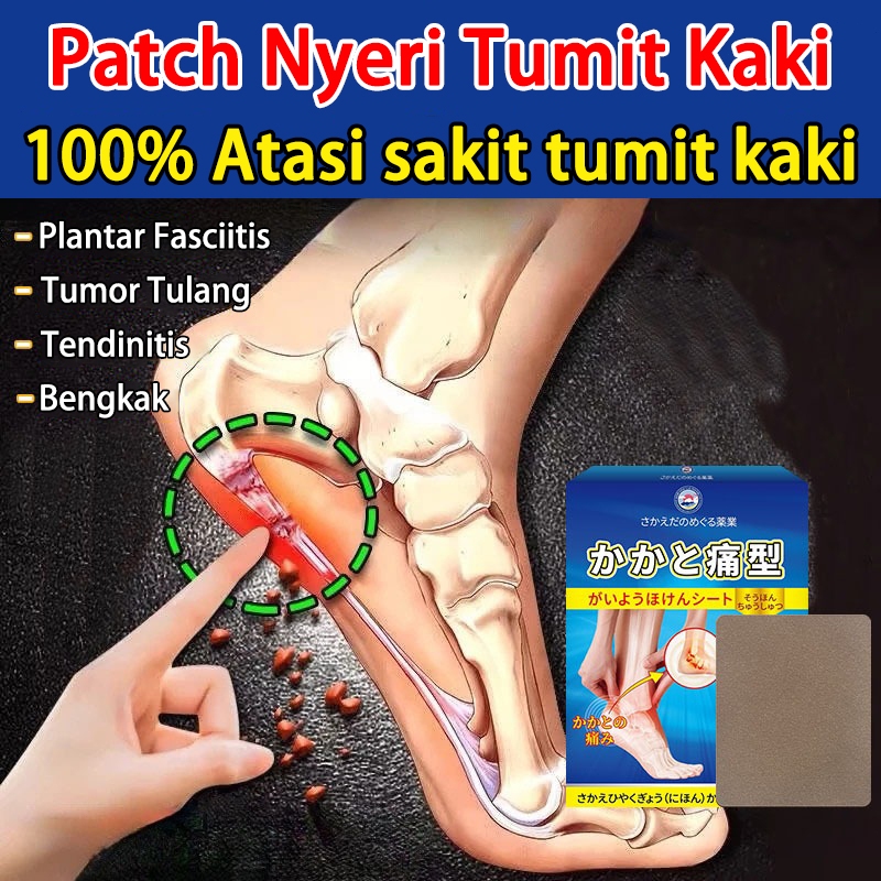koyo kaki pereda nyeri sakit tumit kaki plantar fasciitis 12PCS obat sakit kaki obat sakit tumit ter