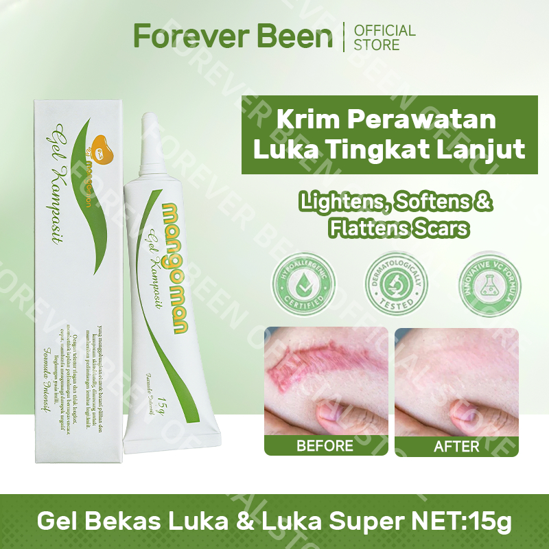 BPOM Krim Perawat Luka Lanjutan untuk Ibu: Menghilangkan Bekas Caesar, Bedah Mata, Luka Lama, Stretc