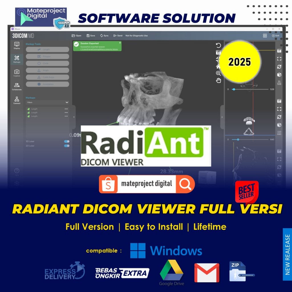 RadiAnt DICOM Viewer 2025 Full Version Permanen Software PACS DICOM viewer gambar medis