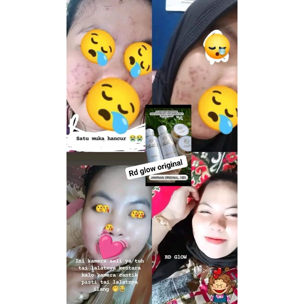 RD GLOW ORIGINAL  / R De'glow / RDE GLOW Rinna diazella