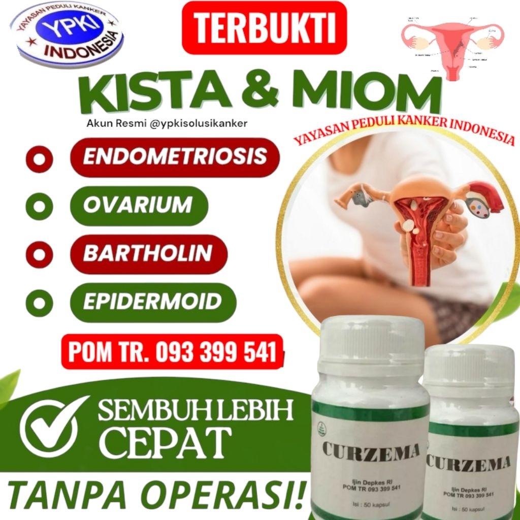 OBAT UNTUK KISTA ENDOMETRIOSIS CURZEMA II OBAT KISTA FUNGSIONAL CURZEMA II OBAT KISTA FOLIKEL CURZEM