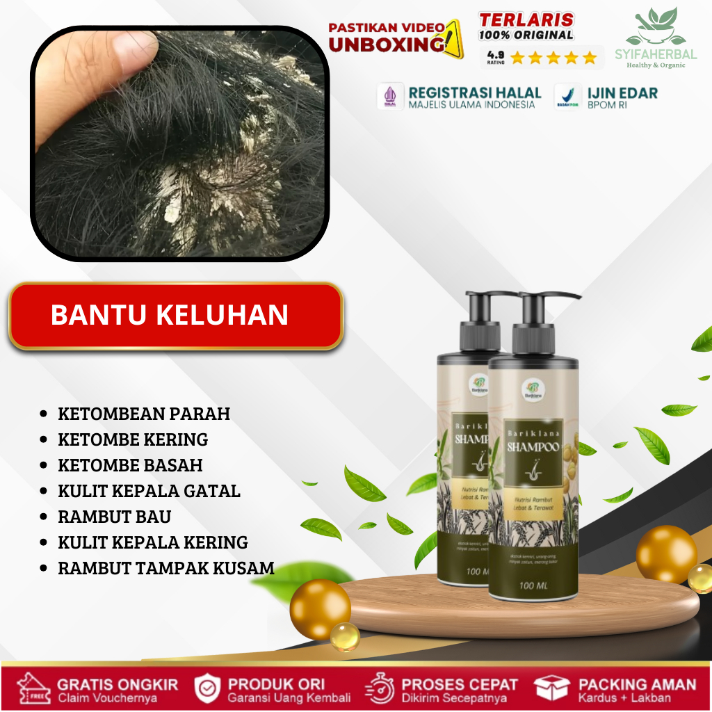Shampo Bariklana Membantu Atasi Ketombe Parah, Ketombe Kering, Ketombe Basah, Ketombe Berkerak, Ramb