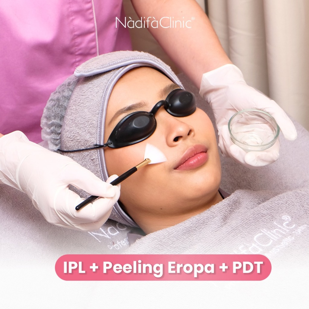 TREATMENT IPL + Peeling Eropa + PDT