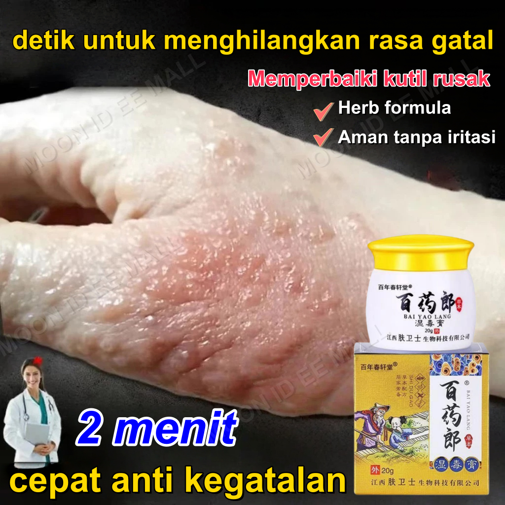 Salep gatal china paling ampuh Salep Gatal Selangkangan Obat Jamur Kulit Psoriasis Cream Obat Eksim 