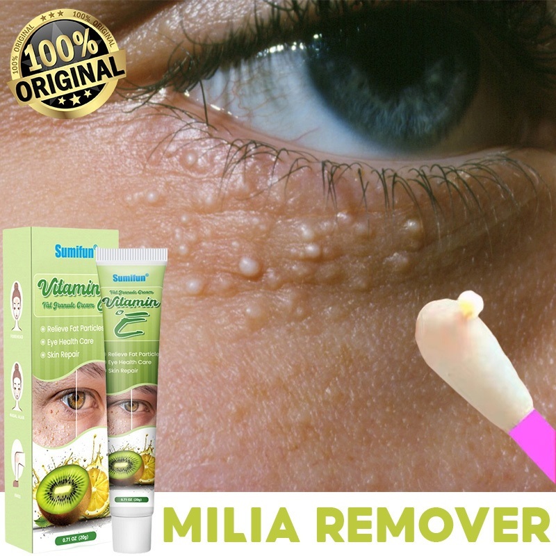Krim Penghilang Milia 20g Krim Mata Agen Penghilang Milia Obat Milia untuk Bawah Mata Krim Milia Pen