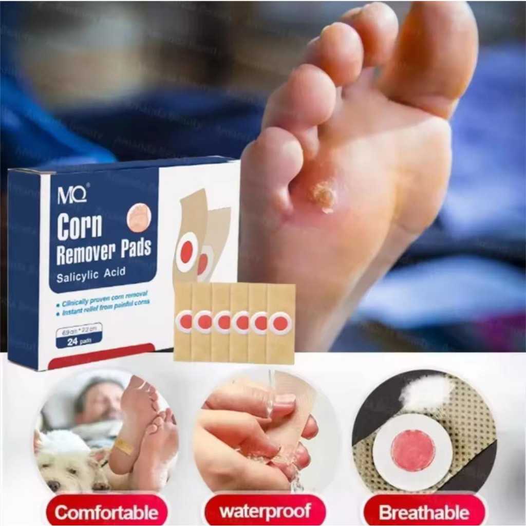 173 Plester Mata Ikan 24pcs Mata Ikan Di Kaki Plester Kutil Foot Corn Removal Penutup Koyo Kaki Ples