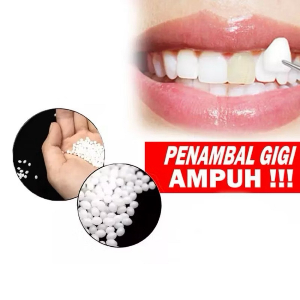 Penambal gigi berlubang 50 butir/100 butir | Tempooth | gigi palsu