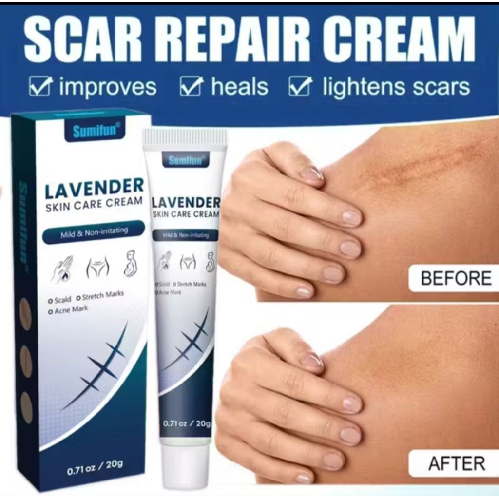 SALEP PENGHILANG BEKAS LUKA MENGHILANGKAN BEKAS LUKA KORENG SCAR REMOVER CREAM KELOID STRETCH MARK 2