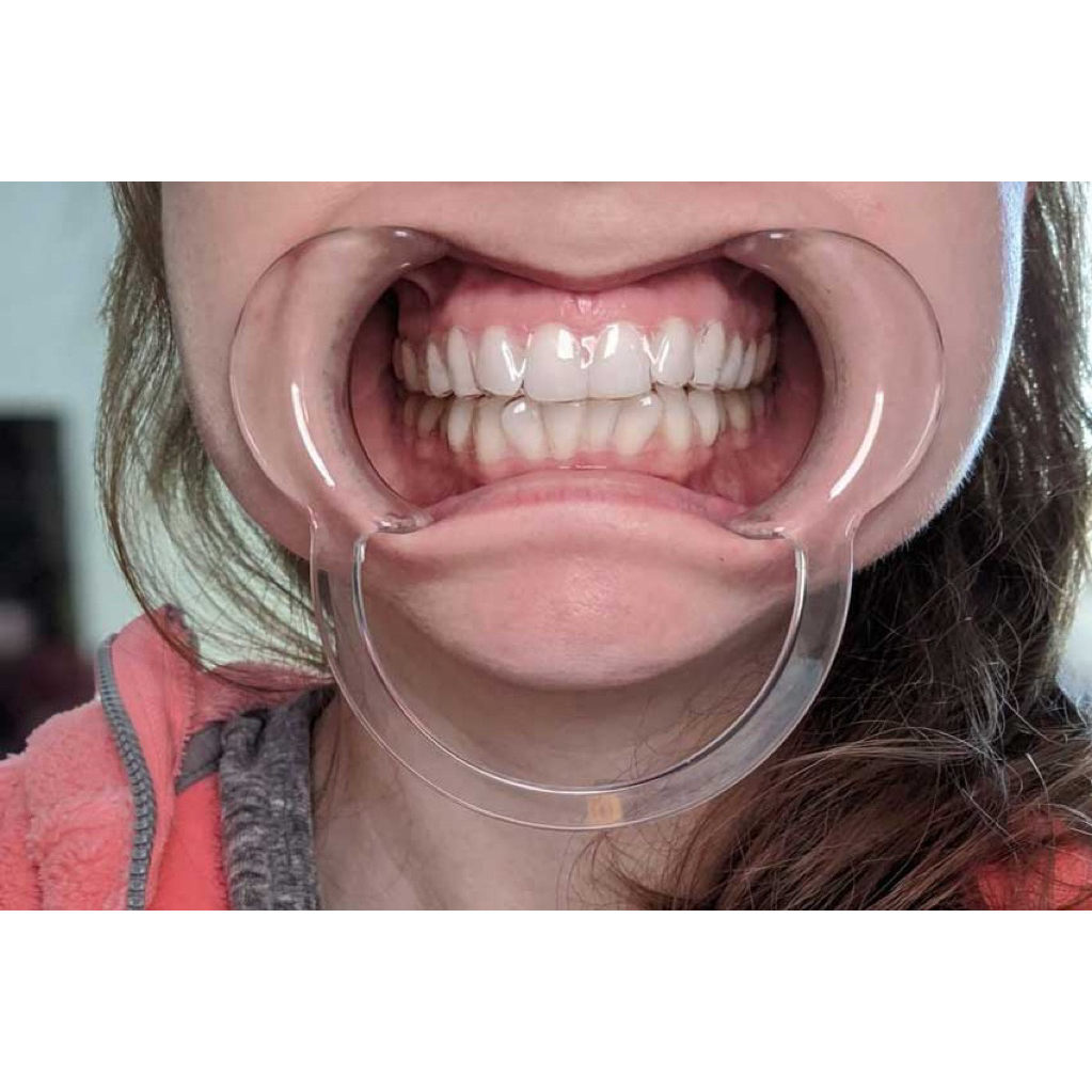 Cheek Retractor & Lip Retractor