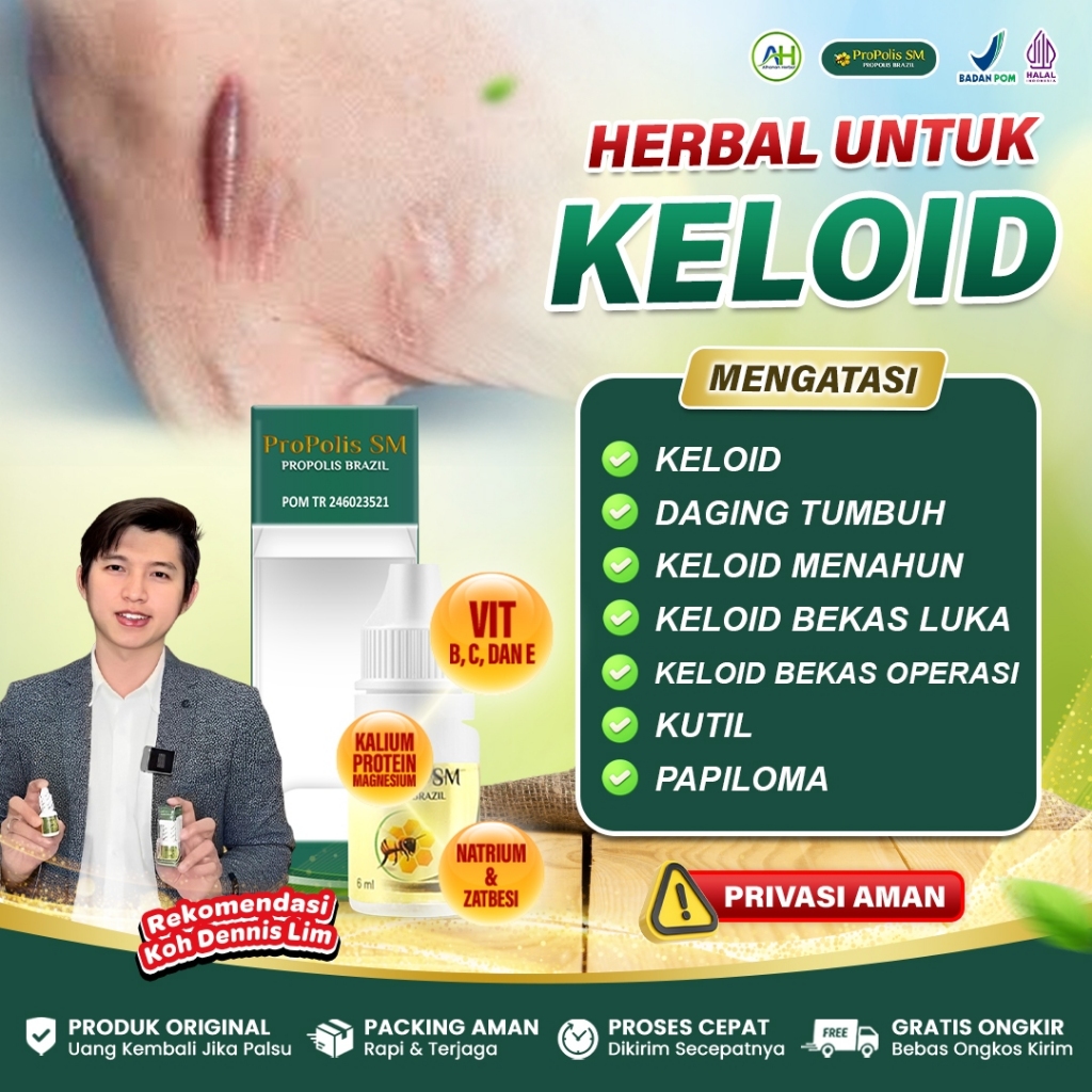 Obat Keloid Daging Tumbuh, Keloid Menahun, Keloid Bekas Luka Operasi, Kutil Papiloma - Propolis SM