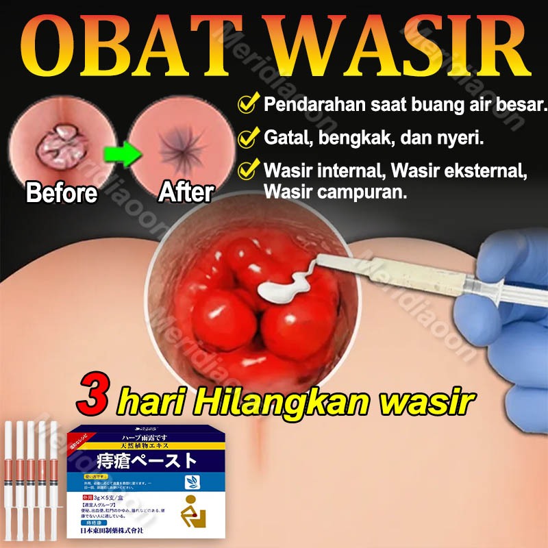 Obat Wasir Obat ambeien Gel wasir Herbal Salep Wasir Salep Ambeien Paling Ampuh Obat Hemoroid Mengat