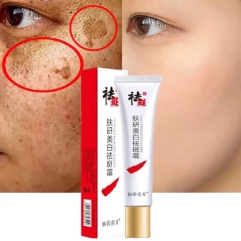 CREAM PENGHILANG FLEK HITAM, JERAWAT, DAN BEKAS JERAWAT