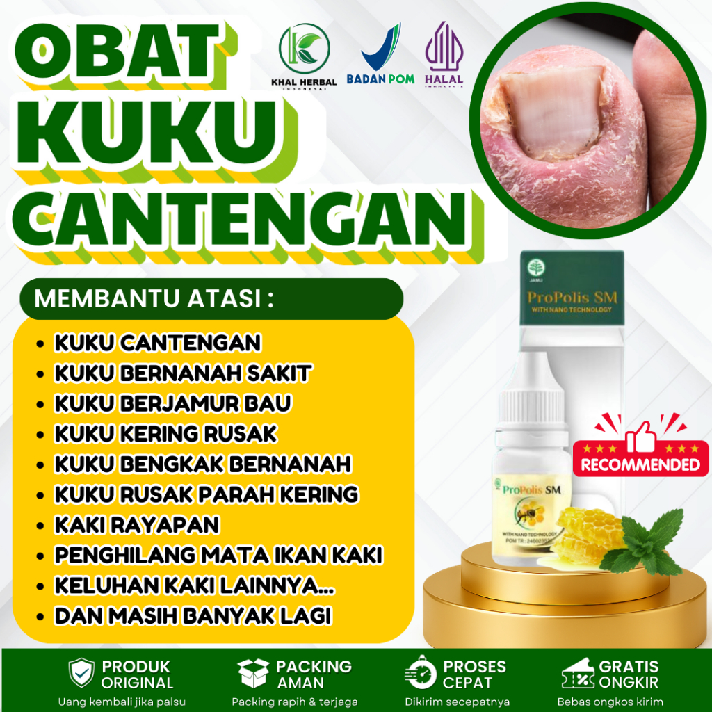 Obat Kuku Cantengan - Obat Cantengan Jempol - Obat Cantengan - Obat Oles Kuku Cantengan - Obat Caten