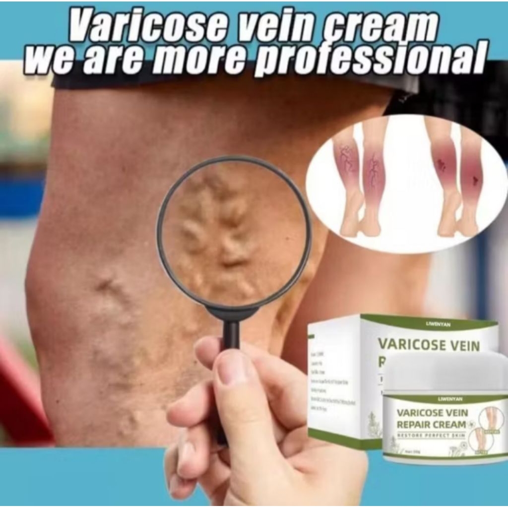 Dekastore lui | Krim Penghilang Varises Di kaki Liwenyan Varicose Venis Cream