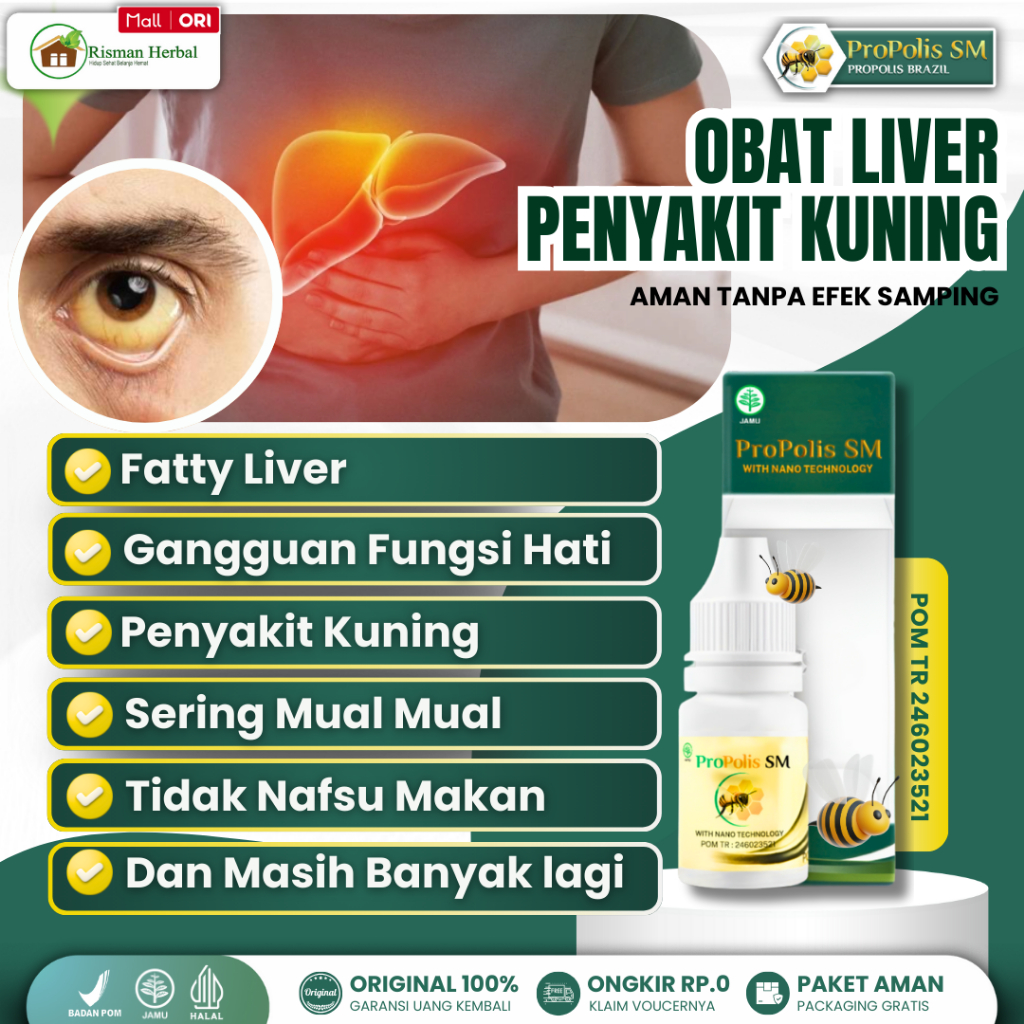 Obat Penyakit Kuning Fatty Liver Hati Berlemak Hepatitis Propolis Sm Brazil