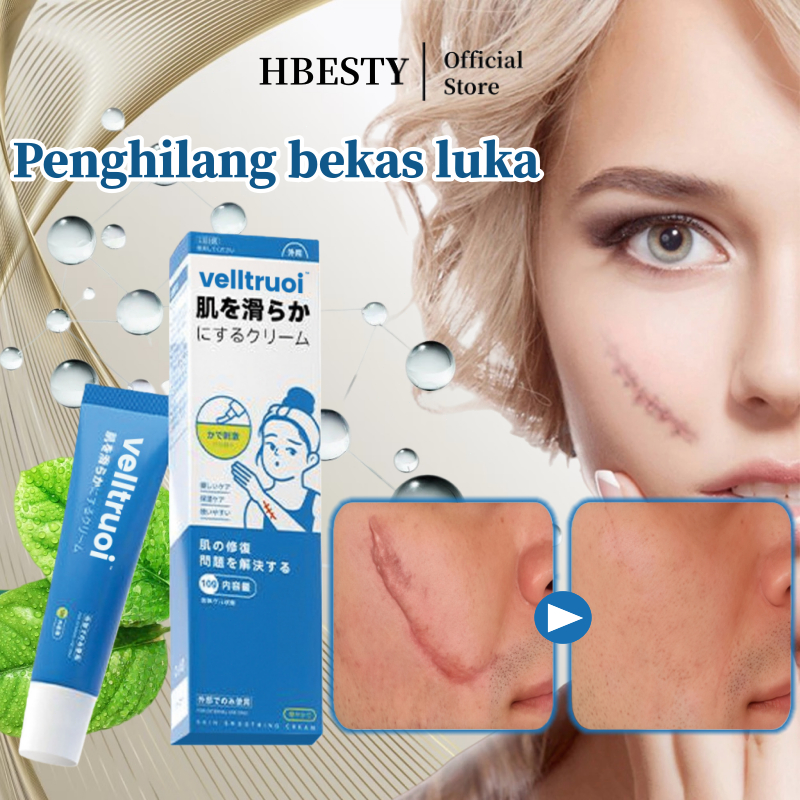 HBESTY Penghilang bekas luka Cream penghilang bekas luka koreng Scar cream Menghilangkan bekas luka 