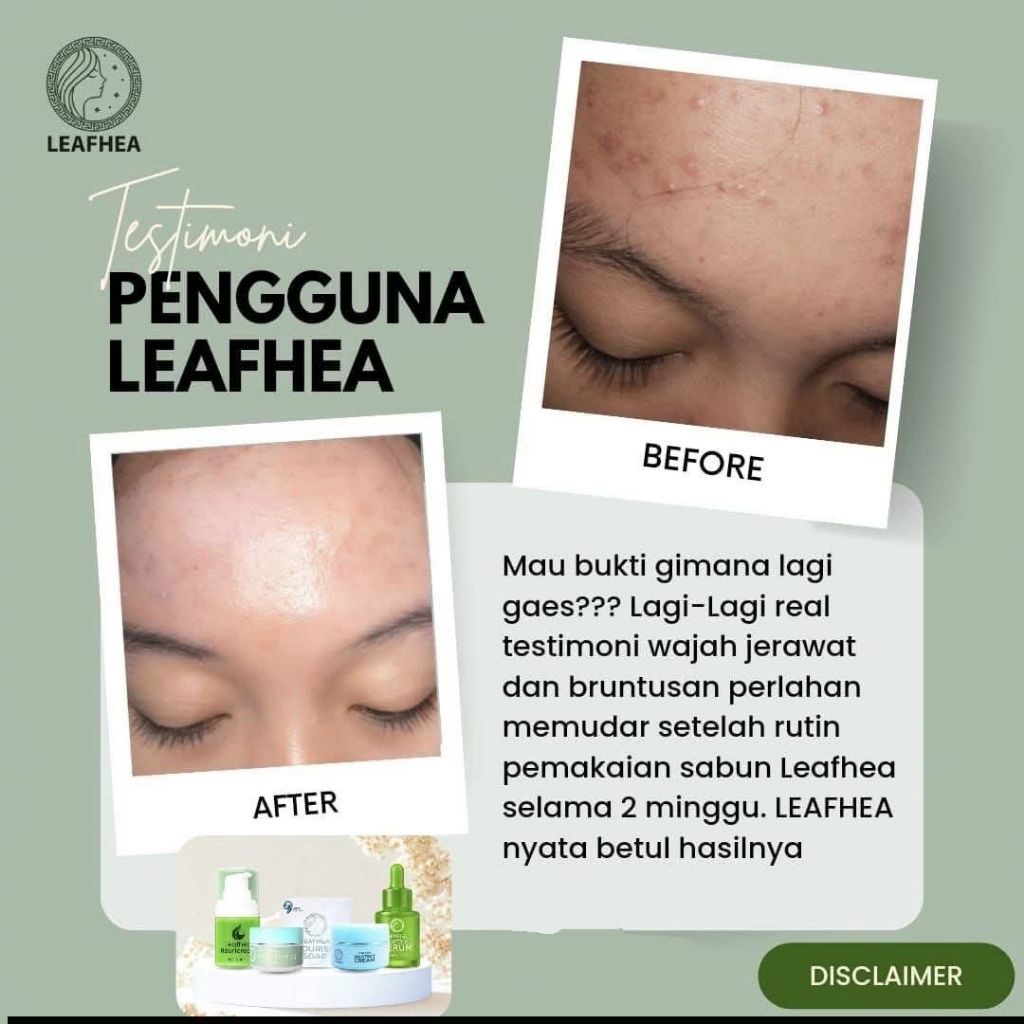 SABUN LEAFHEA MURAH BPOM