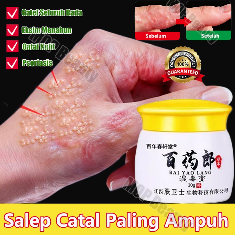 Salep gatal salep eksim kering dan gatal salep china gatal paling ampuh eksim kering salep gatal sel
