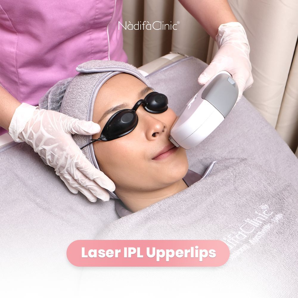 LASER IPL UPPERLIPS