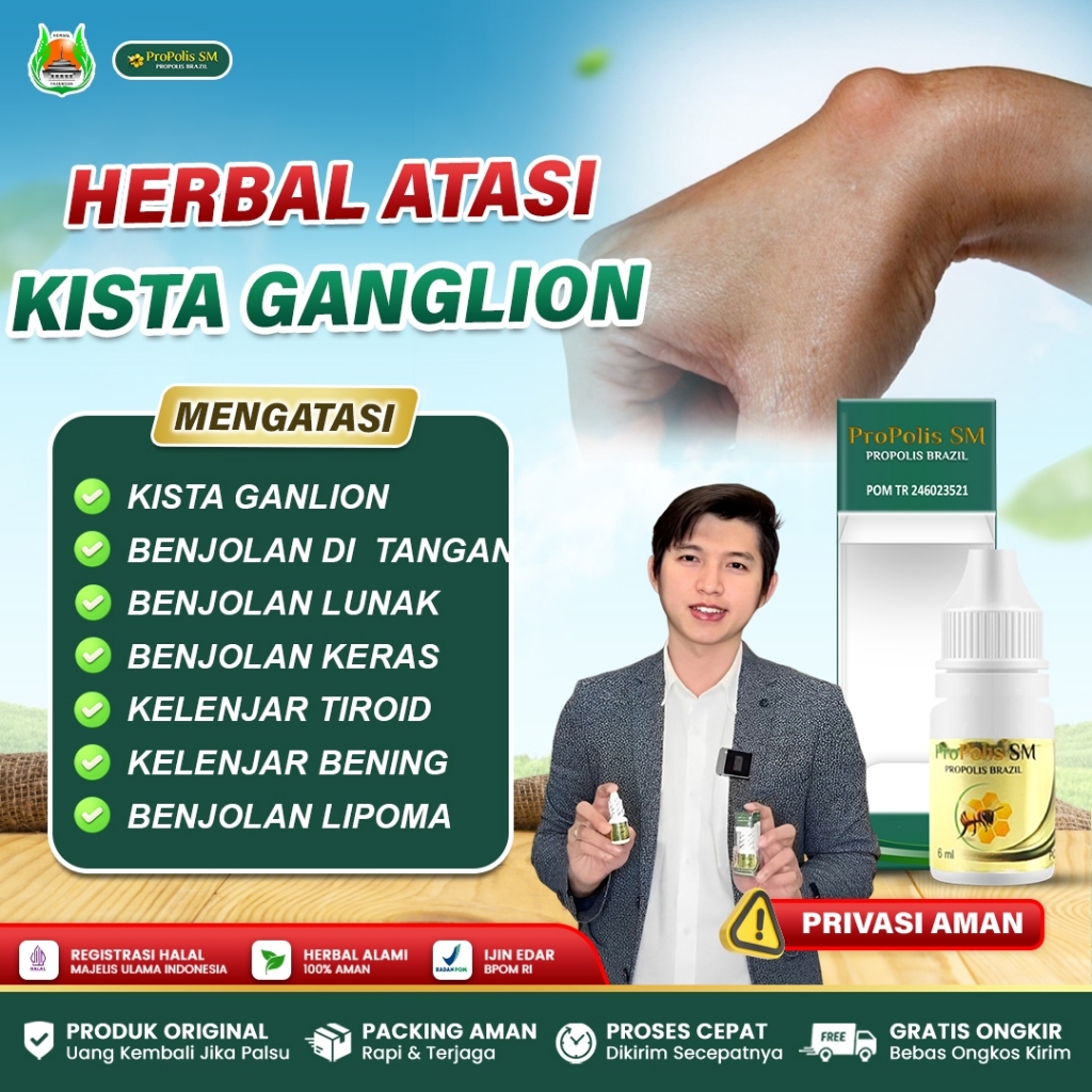 Obat Kista Ganglion, Benjolan Di Tangan, Penghancur Benjolan Ganglion, Benjolan Lunak - Propolis SM