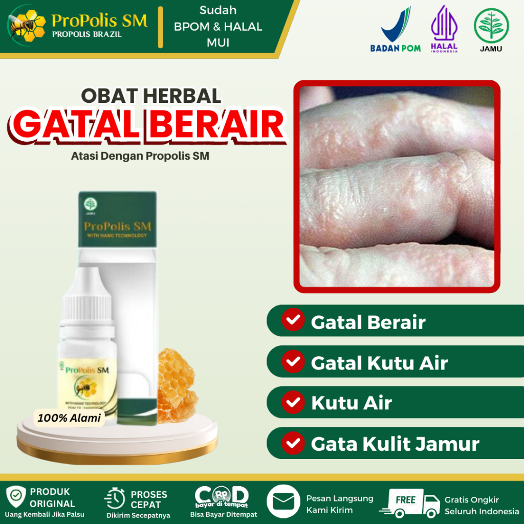 Obat Gatal Berair, Gatal Kutu Air di Sela Jari Tangan, Gatal Berair di Kaki, Gata Kulit Jamur, Salep