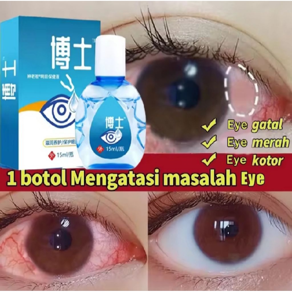 YEHUANGSU OBAT TETES MATA NO 1 JEPANG / TETES MATA JEPANG OBAT TETES MATA BERLEMAK KEKUNINGAN PTERIG