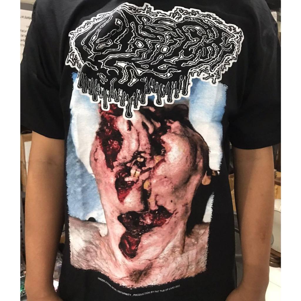ORIGINAL TSHIRT FETAL DEFORMITY - Death's Pathological Fixations
