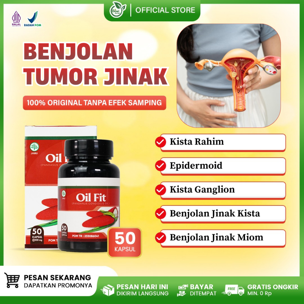 Obat Miom, Kista Ovarium, Kista Ganglion, Epidermoid, Kista Ginjal, Benjolan Tumor Jinak Kista & Mio
