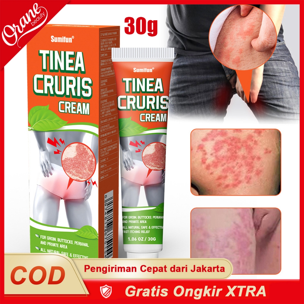 Oranebeauty 30g Salap gatal kulit yang ampuh obat gatal selangkangan salep gatal Obat Gatal Kelamin 