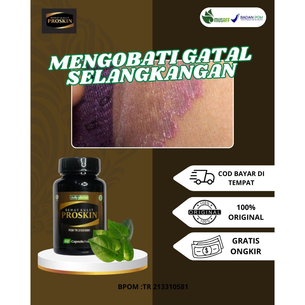 Obat Kutu Air Di Jari Tangan, Obat Kutu Air, Obat Gatal di Sela Jari Kaki dan Tangan, Obat Gatal