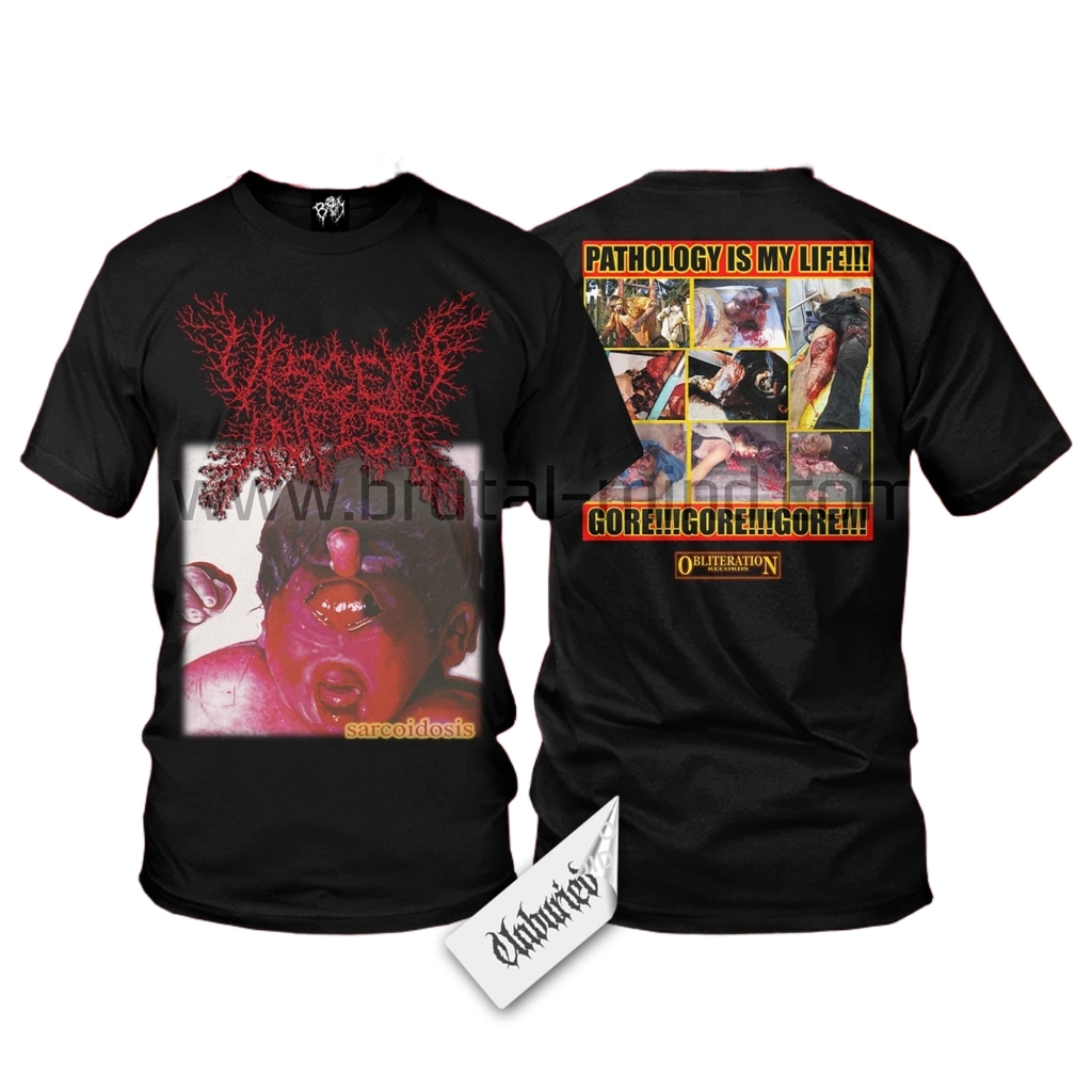 Short Sleeve - Viscera Infest - Sarcoidosis