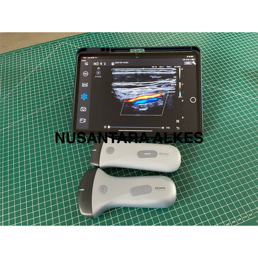 PROMO EDAN NANO USG WIRELESS / USG WIFI / USG POCKET / USG MINI / PROBE OBGYN / PROBE LINEAR MURAH D