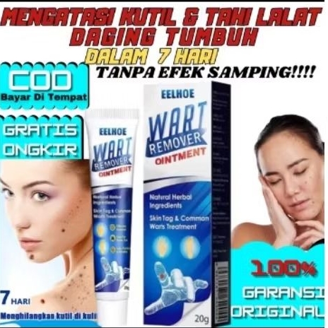 COD -Efek bagus Obat Kutil paling ampuh Oles Penghilang Kutil 20g manjur tanpa operasi mahal penghap