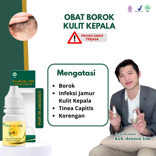 Obat Borok Kepala - Infeksi Jamur Kulit Kepala - Tinea Capitis - Korengan Propolis Brazilian SM