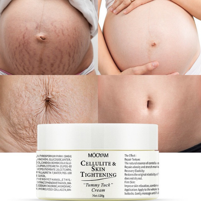 Cellulite Tummy TuckCream & Scar Remover