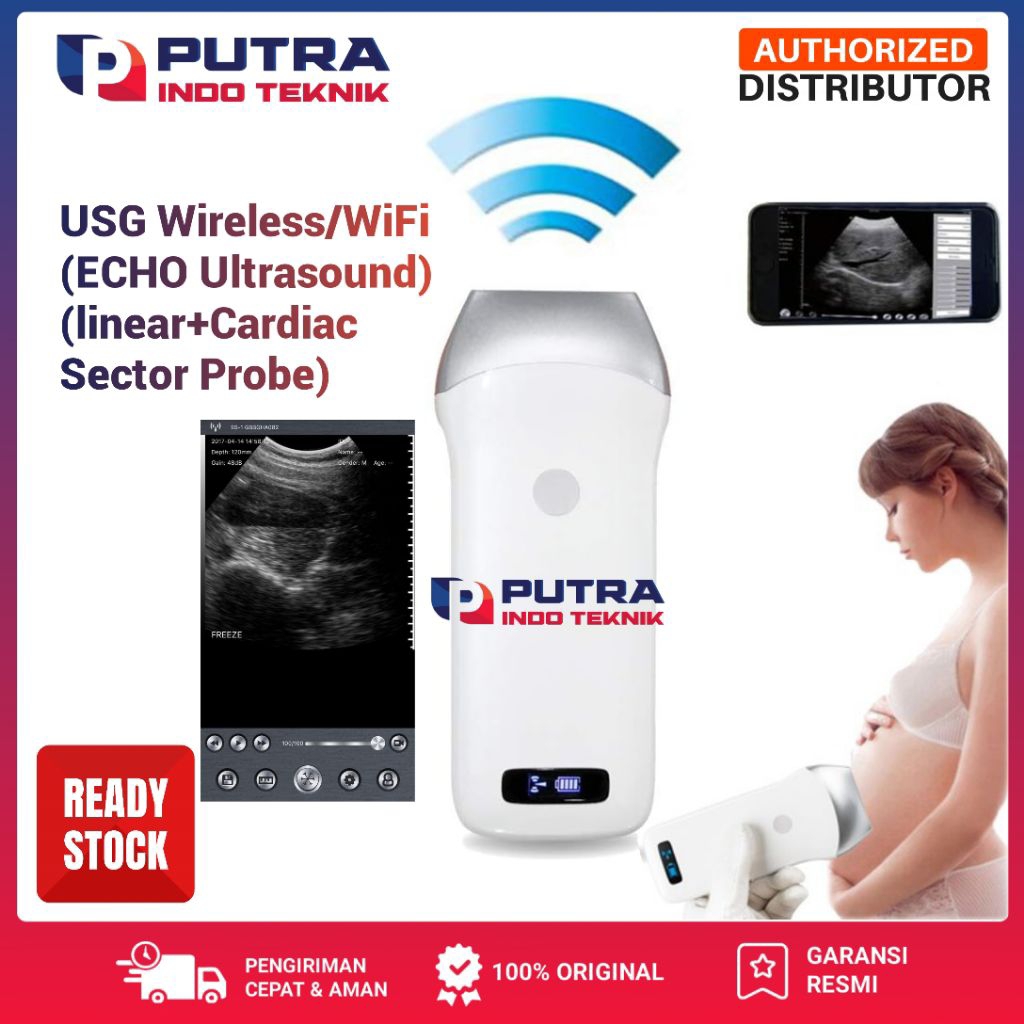 USG Portable Linear Wireless Wifi Probe Ultrasond Scranner Androit Apple Windows Kompitabel