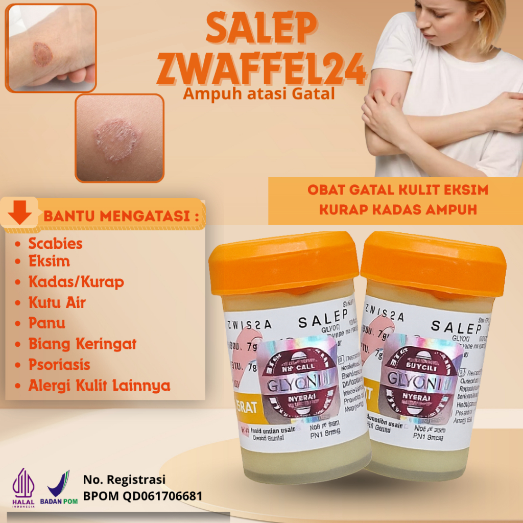 Zwafel 24 Itchy 234 Obat Gatal Kulit Eksim Kurap Kadas Ampuh Original