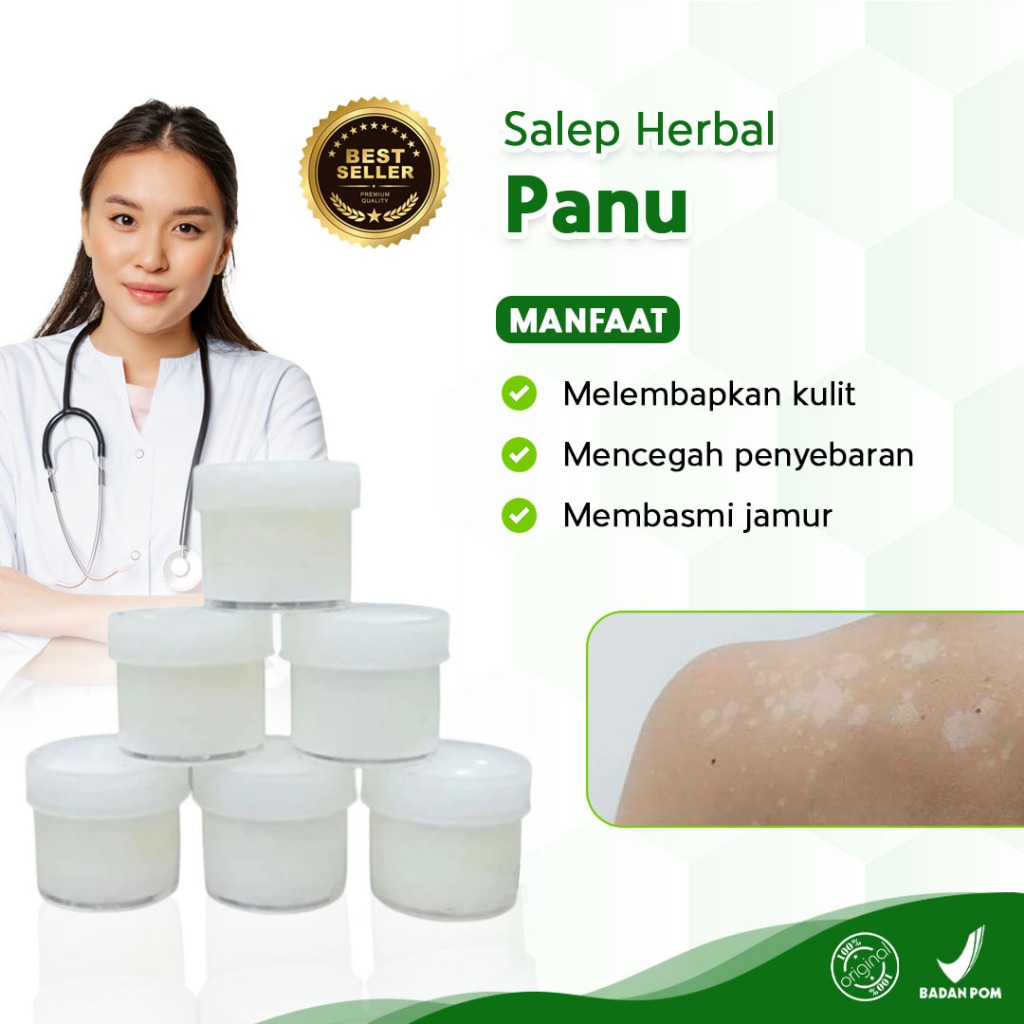 Salep Panu Kadas Kurap Serbaguna Paling Ampuh Salep Panu Paling Ampuh untuk Penyakit Kulit