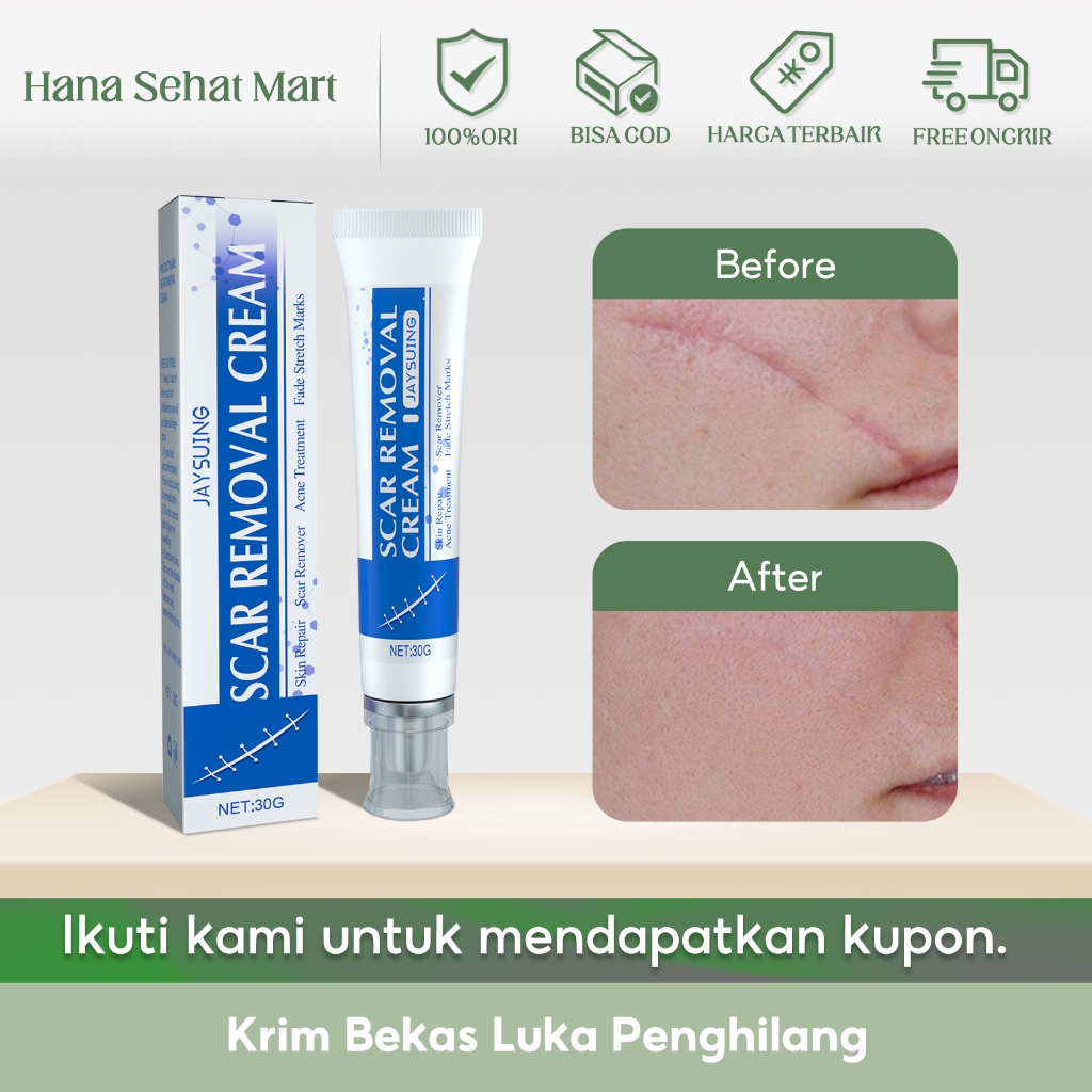 Jaysuing Krim Bekas Luka Penghilang 30g Krim Perbaikan Bekas Luka Meringankan Bekas Luka Trauma Beka