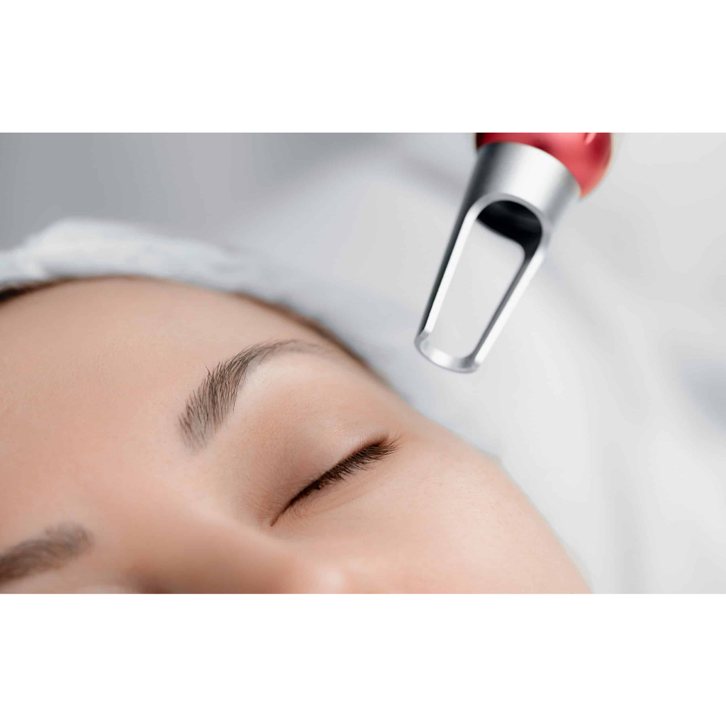 Ndia Pico Laser - Klinik Kecantikan Ndia Beauty Care (Voucher Treatment)