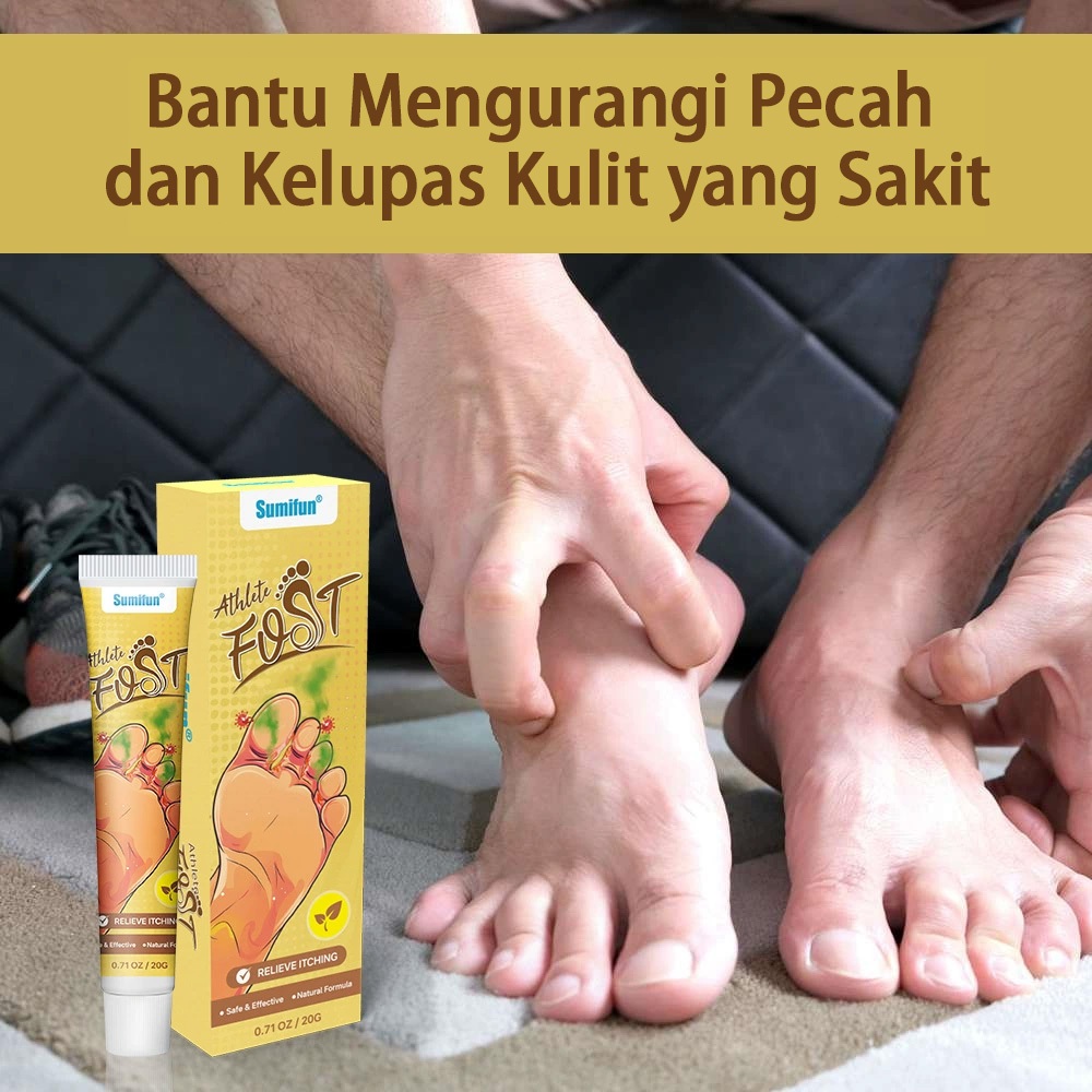 Sumifun Salep Obat Kaki Jamur Gatal Rayapan 20g – Paling Ampuh, Perawatan Telapak Kaki Gatal Kulit A