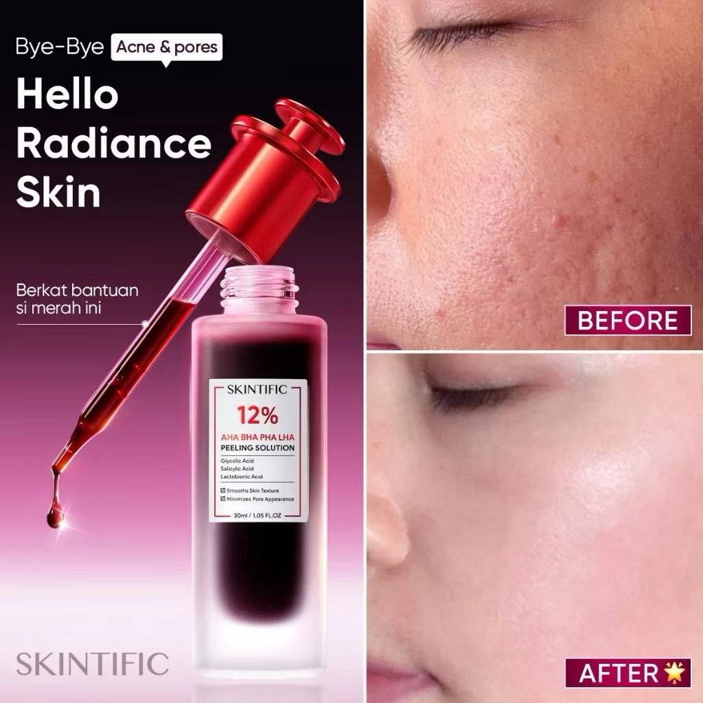 Skintific serum peeling | Skintific exfoliating serum |Serum eksfoliasi Skintific | Serum pengangkat